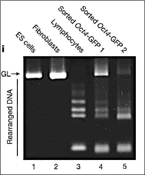 electrophoresis